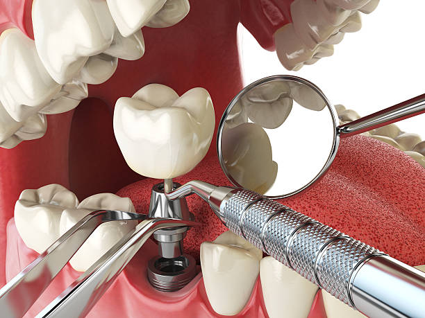 Best Emergency Dental Extractions in Folkston, GA